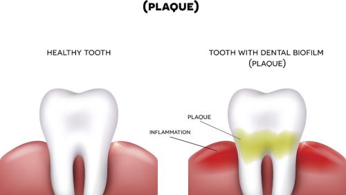 牙科材料如何申请俄罗斯医疗器械注册证 牙科材料如何申请俄罗斯医疗器械注册证